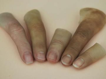 Cosmetic restored finger
